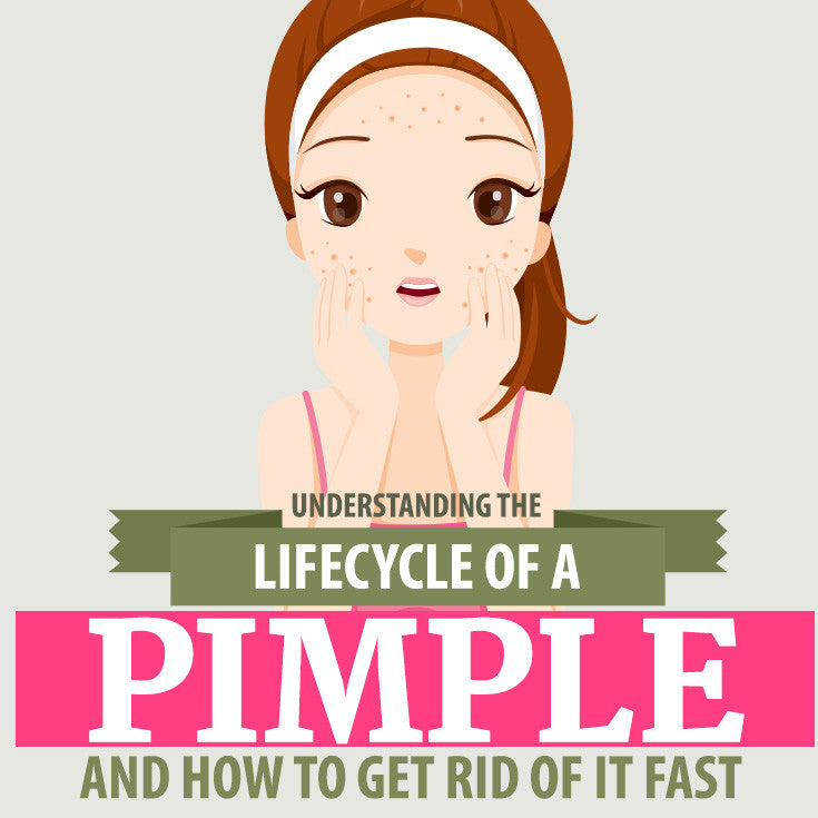 Understanding the Life Cycle of a Pimple and How to Get Rid of it Fast
